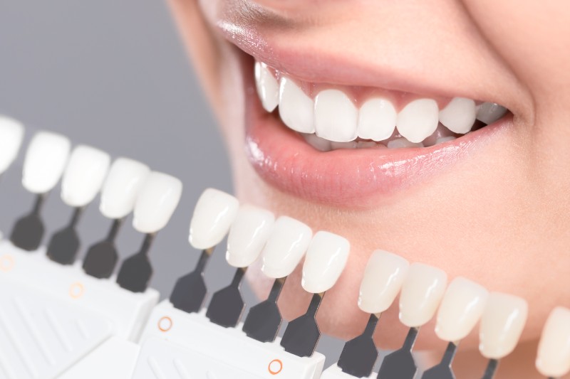 What Are Some of the Health Benefits Associated With Teeth Whitening?