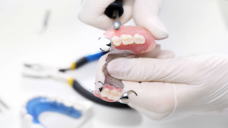 Learn About the Fundamentals of Dental Implants in Philadelphia